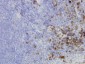 HERPUD1 Antibody (monoclonal) (M04)