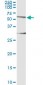 HERPUD1 Antibody (monoclonal) (M04)