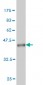 HERPUD1 Antibody (monoclonal) (M04)
