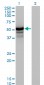 HERPUD1 Antibody (monoclonal) (M04)