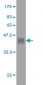 HFE Antibody (monoclonal) (M01)