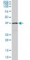 HFE Antibody (monoclonal) (M01)