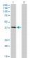 HFE Antibody (monoclonal) (M01)