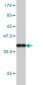 HGS Antibody (monoclonal) (M01)
