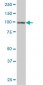 HGS Antibody (monoclonal) (M01)