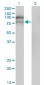 HGS Antibody (monoclonal) (M01)