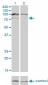 HGS Antibody (monoclonal) (M01)