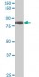 HIC1 Antibody (monoclonal) (M01)