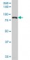 HIC1 Antibody (monoclonal) (M01)