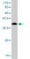 HIC1 Antibody (monoclonal) (M02)