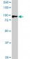 HIC1 Antibody (monoclonal) (M02)