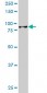 HIC1 Antibody (monoclonal) (M02)