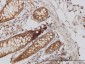 HIP1 Antibody (monoclonal) (M01)