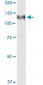 HIP1 Antibody (monoclonal) (M01)