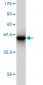 HIP1 Antibody (monoclonal) (M01)
