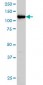 HIP1 Antibody (monoclonal) (M01)