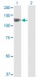 HIP1 Antibody (monoclonal) (M01)