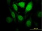 HIPK1 Antibody (monoclonal) (M04)