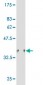 HIPK1 Antibody (monoclonal) (M04)