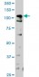 HIPK1 Antibody (monoclonal) (M04)