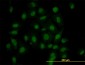 HIPK1 Antibody (monoclonal) (M07)