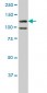 HIPK1 Antibody (monoclonal) (M07)