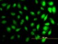 HIST1H3D Antibody (monoclonal) (M01)