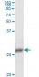 HLA-DPB1 Antibody (monoclonal) (M01)