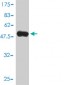 HLA-DPB1 Antibody (monoclonal) (M01)