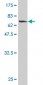 HMBS Antibody (monoclonal) (M01)