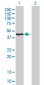 HMBS Antibody (monoclonal) (M01)