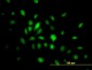 HMG20B Antibody (monoclonal) (M01)