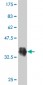 HMGA2 Antibody (monoclonal) (M01)