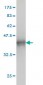 HMGB1 Antibody (monoclonal) (M08)