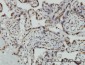 HMGB2 Antibody (monoclonal) (M04)