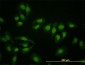 HNF4A Antibody (monoclonal) (M04)