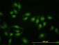 HNF4A Antibody (monoclonal) (M04)