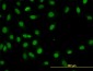 HNF4A Antibody (monoclonal) (M07)