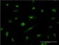 HNRPM Antibody (monoclonal) (M01)