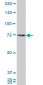 HNRPM Antibody (monoclonal) (M01)