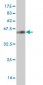 HNRPM Antibody (monoclonal) (M03)