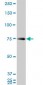 HNRPM Antibody (monoclonal) (M03)