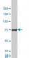 HNRPM Antibody (monoclonal) (M03)