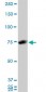 HNRPM Antibody (monoclonal) (M03)