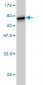 HORMAD1 Antibody (monoclonal) (M01)