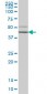 HORMAD1 Antibody (monoclonal) (M01)