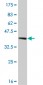 HOXA11 Antibody (monoclonal) (M05)