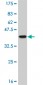 HOXA11 Antibody (monoclonal) (M08)