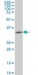 HOXA11 Antibody (monoclonal) (M08)