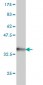 HOXA7 Antibody (monoclonal) (M01)